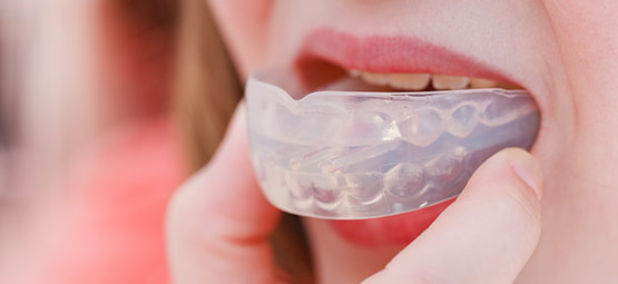 Das Tragen eines Sportmundschutzes beugt Verletzungen der Zähne bei Kindern, Teenagern und Erwachsenen vor. Infos erhalten Sie bei Hoffmann Dental.